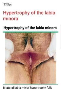 لابیاها