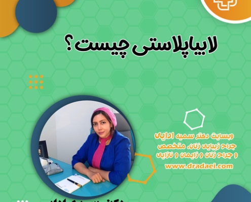 لابیاپلاستی