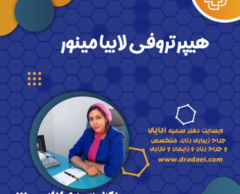 لابیا مینور