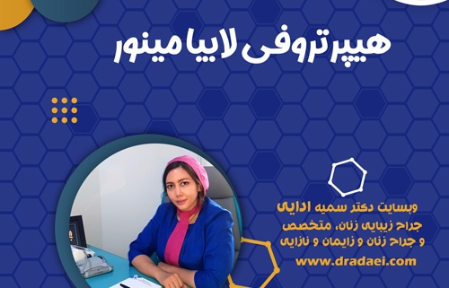 لابیا مینور