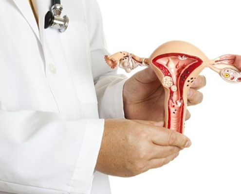 تصویر-آدنومیوز-رحم-5265