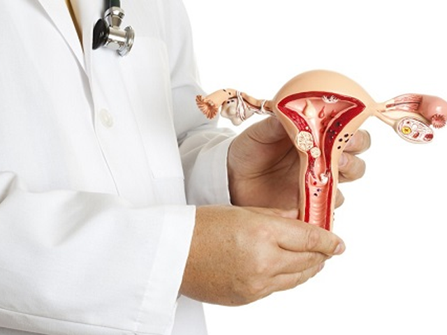 تصویر-آدنومیوز-رحم-5265