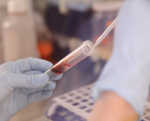 تصویر-غربالگری-سرطان-تخمدان-8522