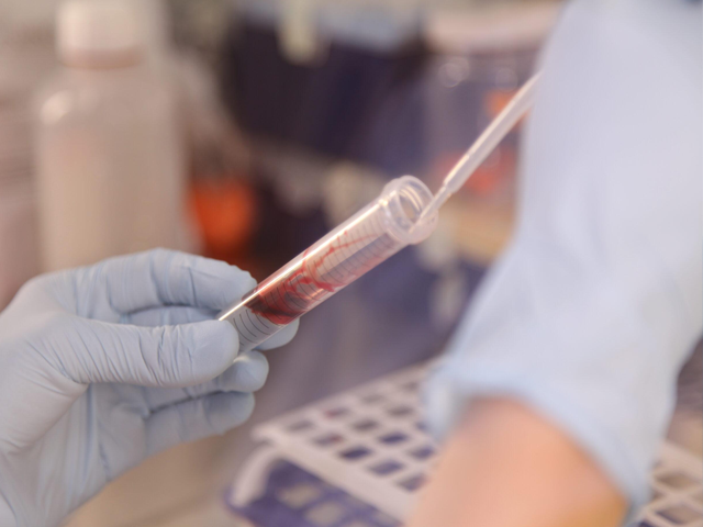 تصویر-غربالگری-سرطان-تخمدان-8522