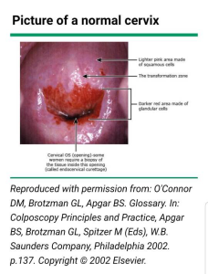تصویر-غربالگری-سرطان-دهانه-رحم-8754