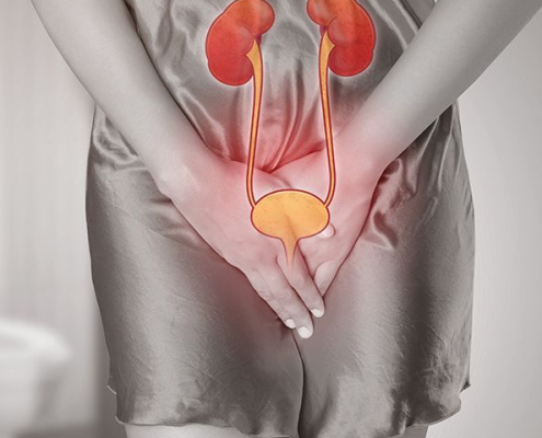 تصویر-بی-اختیاری-ادرار-زنان-8639