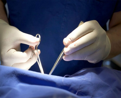 تصویر-لابیاپلاستی-به-همراه-عکس-قبل-و-بعد-از-عمل-لابیاپلاستی-9484