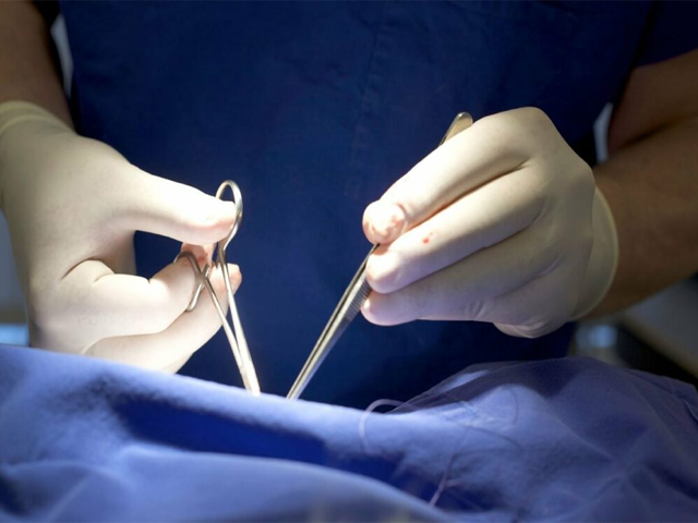 تصویر-لابیاپلاستی-به-همراه-عکس-قبل-و-بعد-از-عمل-لابیاپلاستی-9484