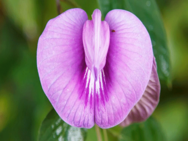 تصویر-خونریزی-بعد-از-عمل-لابیاپلاستی-6363