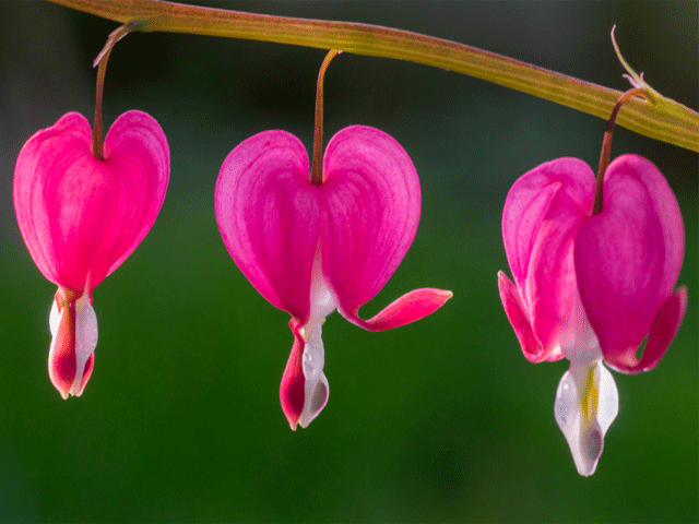 تصویر-خونریزی-بعد-از-عمل-لابیاپلاستی-8654