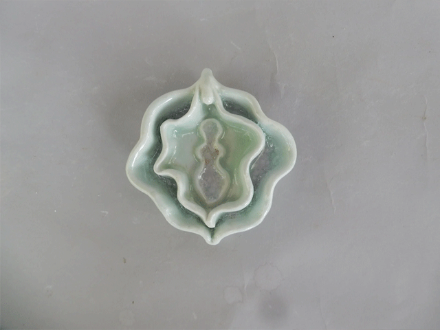 تصویر-تجربه-عمل-لابیاپلاستی-8373