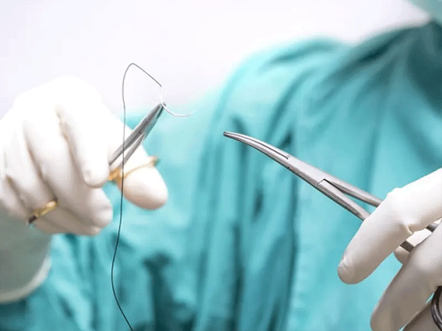 تصویر-لابیاپلاستی-بدون-درد-و-خونریزی-8768