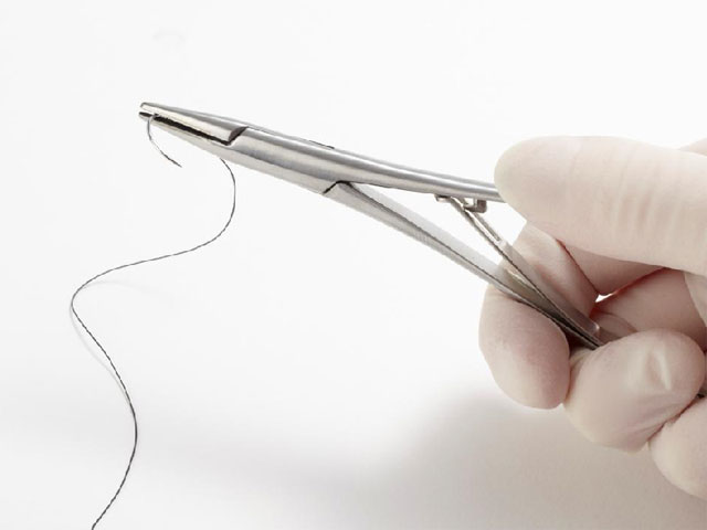 تصویر-چند-روز-بعد-از-عمل-لابیا-بخیه-ها-میوفته-9763