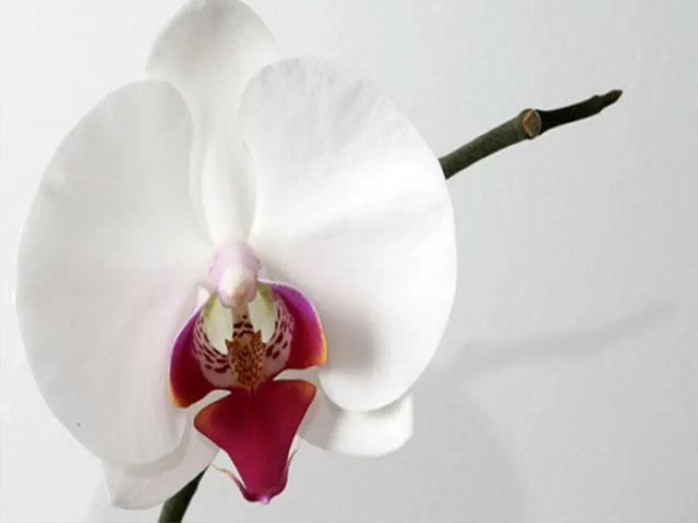 تصویر-آیا-لابیاپلاستی-درد-دارد؟-8733