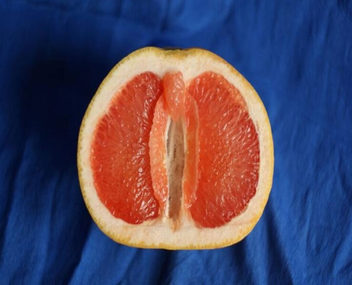 تصویر-باورهای-غلط-درباره-لابیاپلاستی-8749