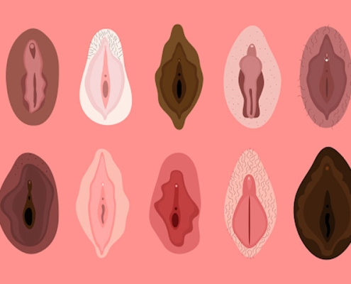 تصویر-صفر-تا-صد-لابیاپلاستی-8733