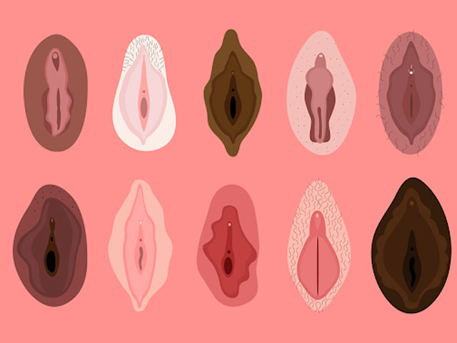 تصویر-صفر-تا-صد-لابیاپلاستی-8733