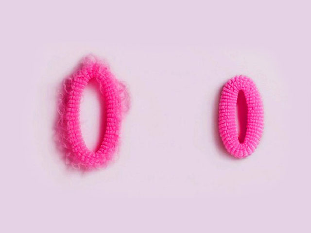 تصویر-ماندگاری-عمل-تنگی-واژن-8844