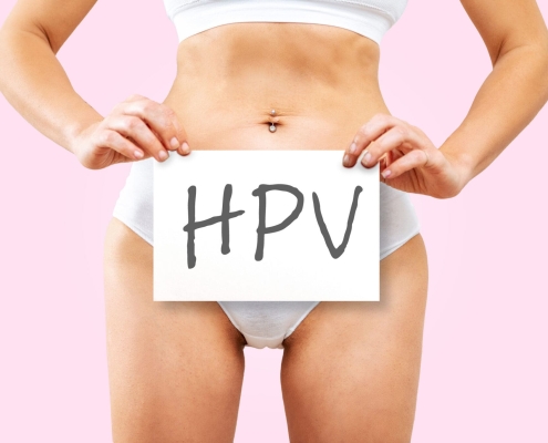 زگیل تناسلی