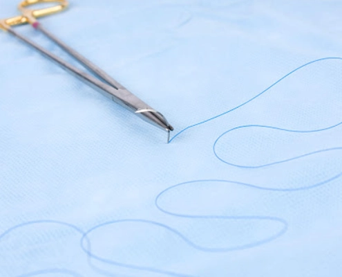 بالا کشیدن واژن با نخ