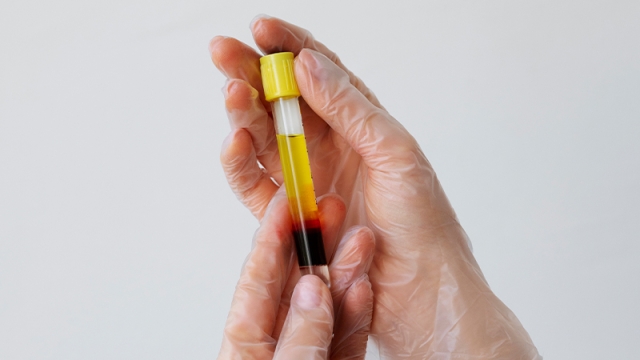 پلاسماتراپی واژن