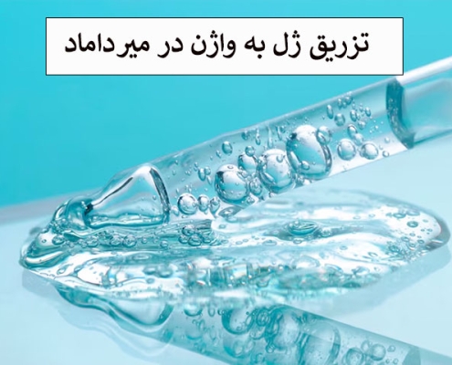 تزریق ژل به واژن در میرداماد