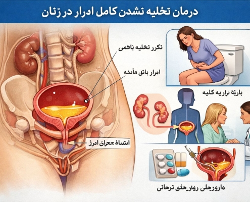 درمان تخلیه نشدن کامل ادرار در زنان